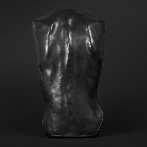 SCOLIOSIS